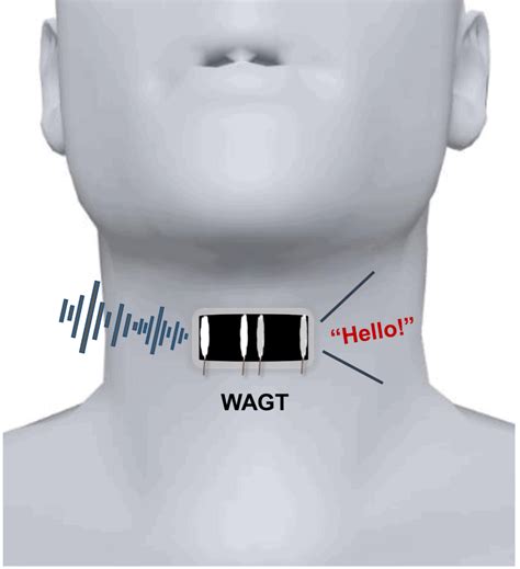 metal voice box|laryngeal artificial voice box.